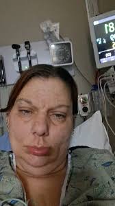 I'm hospital 2 days.lupus flare gave me bad heart attack from sever  inflammation if heart muscles. It also attacked my kidney.been in a flare a  month again