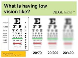 Vision Test Charts Flow Charts