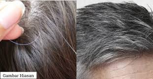 Punca keguguran rambut biasanya berlaku akibat shampoo atau perapi rambut yang mengandungi sama ada anda lelaki atau perempuan, usia muda remaja atau orang dewasa, rambut gugur boleh atasi rambut gugur cara tradisional guna limau purut. Uban Tumbuh Di Usia Muda Ini Penjelasan Yang Anda Perlu Tahu