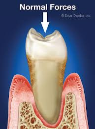 Crowns can also be replaced if they break, stain, or you want a new one for whatever reason. Loose Teeth Biting Forces Can Loosen Teeth