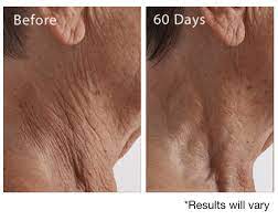 Maybe you would like to learn more about one of these? Crepe Erase Reviews Don T Buy Before Reading This 2021