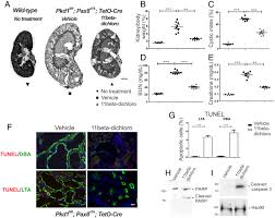 A synthetic agent ameliorates polycystic kidney disease by promoting  apoptosis of cystic cells through increased oxidative stress