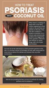 Additional benefits of coconut oil include restoration of the existing 8 properties of coconut oil for hair. How To Treat Psoriasis With Coconut Oil Diy Natural Home Remedies Here Are Some Of The Reasons Schuppenflechte Schuppenflechte Heilen Naturliche Hausmittel