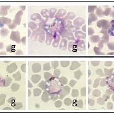Thick and thin blood smears of the patient are manually examined by an expert pathologist with the help of a microscope to diagnose the disease. Malaria Parasites Of The Wtd As Viewed Under The Light Microscope Download Scientific Diagram