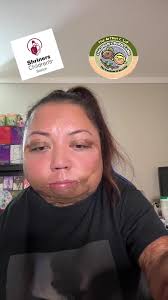 Ashburn Hospital Dunedin