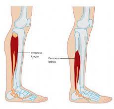 Pictures of muscle atrophy in legs. Leg Calf Muscles Atrophy Acunatural Health