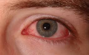 This Is Why You Get Red Eyes After Smoking Weed Cannabismo