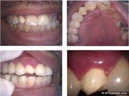 Dr Jeffrey Dorfman Dentist