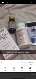 رابطة المتكممين Na Tviteru وختاما تساقط الشعر فتره وبتعدي اهم شي انكم تهتمون بصحتكم وتغذيتكم وبالرابط تجربتي مع تساقط الشعر بعد عملية التكميم Https T Co Kxoxctkpg9 رابطة المتكممين Https T Co Aig432b0kj
