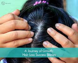 The importance of hair to a woman's appearance and confidence is astounding. How I Grew My Hair Back Women S Hair Loss Amp Regrowth Success Stories Hair La Vie