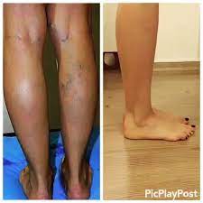 Pin On Home Remedies