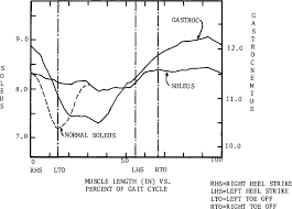 Gait Pattern An Overview Sciencedirect Topics