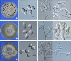 Image result for Botrytis cinerea