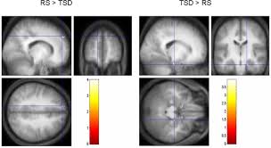 (0 children) it is known that bramante convinced the pope to commission other projects, since he told him that building a tomb while he's still alive was a bad omen. Sleep Modulates The Neural Substrates Of Both Spatial And Contextual Memory Consolidation