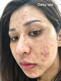 Viện Thẩm Mỹ Daisy