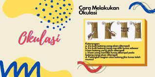 Okulasi Atasan Teknik Kulit