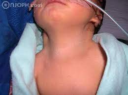 Maybe you would like to learn more about one of these? Atlas Of Ophthalmology