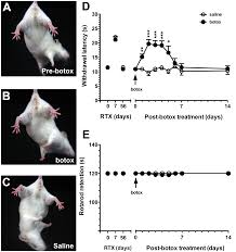 Aug 25, 2020 · how long does botox last on the forehead? Plos One Role Of Peptidergic Nerve Terminals In The Skin Reversal Of Thermal Sensation By Calcitonin Gene Related Peptide In Trpv1 Depleted Neuropathy