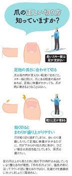 巻き爪 食い込む爪 歩き方や爪の切り方変えてみよう woman smart nikkei style 巻き爪 健康になる 爪