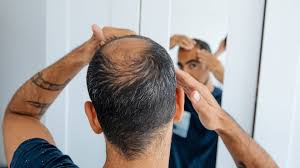 Did UCLA just cure baldness? | University of California