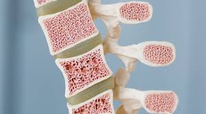 Most blood cells in the body develop from cells in the bone marrow the spongy material in the center of the bones called stem cells. Bone Marrow Cancer Diagnosis And Treatment By Magnus Medi Medium