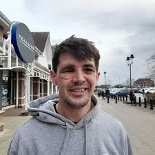 Lincoln councillor 'lucky to be alive' after losing eye in freak accident