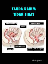 Tanda kiamat sugra yang pertama adalah banyaknya wanita yang berpakaian namun telanjang. Cahaya Mata Tanda Rahim Tidak Sihat Jom Kenali Facebook
