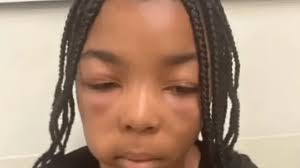 There's No Acceptable Excuse for an Adult Beating a Child