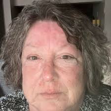 Ashley Furniture stain removal issues