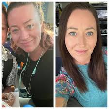 Can we share before and after stories of recovery and sobriety?