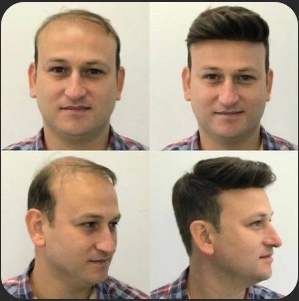 Hair wig hair System for Male product image