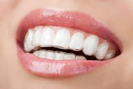 It's true that clear aligners tend to cost more than traditional. How Much Does Invisalign Cost Dublin Orthodontics