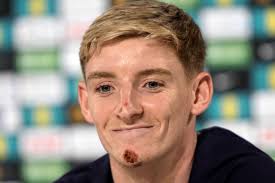 England winger Gordon escapes serious injury from bike accident during  downtime at Euro 2024