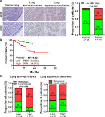 Maybe you would like to learn more about one of these? Long Non Coding Rna Afap1 As1 Accelerates Lung Cancer Cells Migration And Invasion By Interacting With Snip1 To Upregulate C Myc Signal Transduction And Targeted Therapy