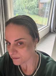 Does my eyes look like there going funny to you guys?