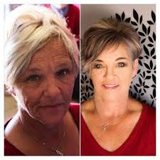 What does a whitening patch