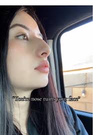 Side Profile with Big Nose and No Jaw Line