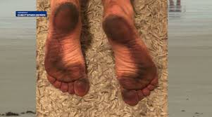 Everyones favorite sister was born sela ann ward on july 11 1956 in meridian mississippi. It S Not Algae What Is Staining People S Feet At Some East Coast Beaches 4state News Mo Ar Ks Ok