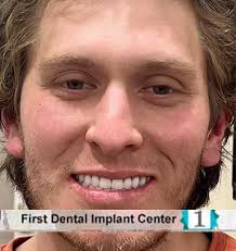First Dental Implant Center