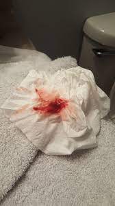 Cervical Check Discharge Or Bloody Show Tmi Pic Included October 2017 Babies Forums What To Expect