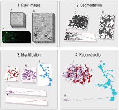 How do learning modalities affect the needs of students? Flexible Learning Free Segmentation And Reconstruction Of Neural Volumes Scientific Reports