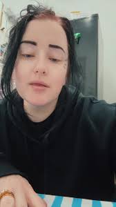 Denture update! #denturegang #noteeth #denture #immediatedentures #update  #journey