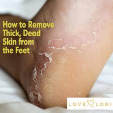In the following section, we. How To Remove Thick Dead Skin From Feet Love Lori