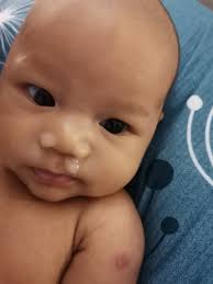 Definisi/arti kata 'pekat' di kamus besar bahasa indonesia (kbbi) adalah a likat atau kental (tidak encer tentang barang cair); Cik Orkid Cara Keluarkan Hingus Dan Kahak Bayi