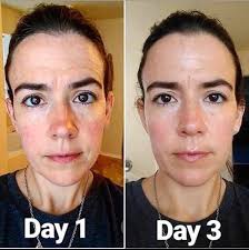 Choose your (skincare) fighter: Olay Retinol24 vs. Regenerist  Micro-Sculpting Cream. Two powerful jars packed with so many benefits that  we thought we'd break it down for you. Comment 💜or ❤️below to pick