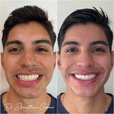 Dr. Jonathan Gabai (@drjonathangabai) · Instagram 照片和视频