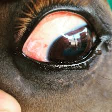Image result for lesion sclera