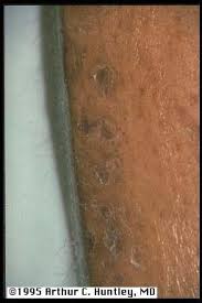 Pin On Dermatology