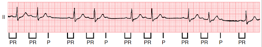 Penilaian ekgcara menilai ekg adalah : Https Skillslab Fk Uns Ac Id Wp Content Uploads 2019 02 Smt 4 Interpretasi Ekg Pdf