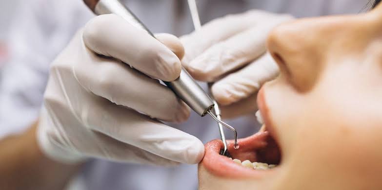 How Long Does a Dental Implant Procedure Take? | Civin, DDS